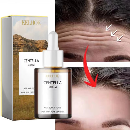 Korean Centella Asiatica Face Serum Nourish Dry Skin Smoothing Rejuvenation Skin Brightening Whitening Cream Facial Moisturizer
